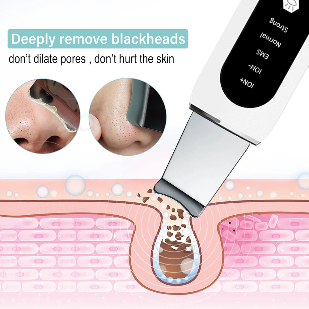 Ultrasonic Skin Scrubber Peeling Blackhead Remover - Healyno